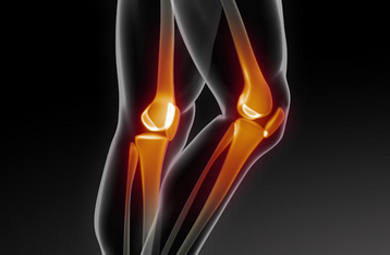 膝关节退行性变怎么治疗