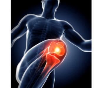 膝关节骨性关节炎的治疗策略